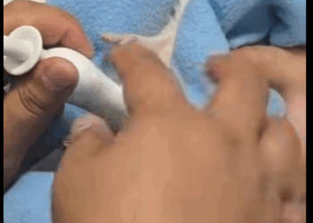 Erizos de rescate (Parte 2)