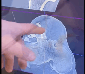 Caballo de rescate (Parte 2)