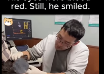 D1712006 His jaw was shattered (Part 2)