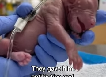 P2712003 Check out bio exclusive content! (Part 2)