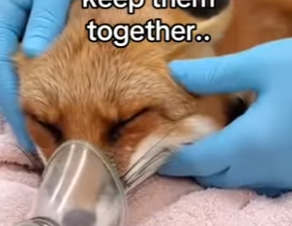 Z2712008 She fell down hill broke her leg (Part 2)