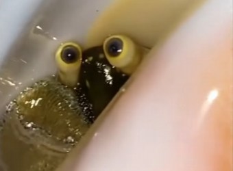 L2701008 Porque cada latido importa (Parte 2)