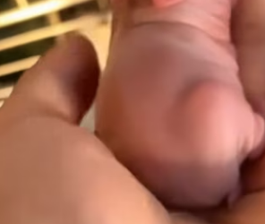 O2912003 found hairless animal in my backyard (Part 2)