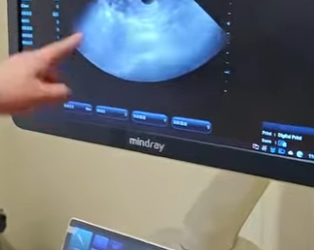 A0702006 hedgehog is really fatal (Parte 2)