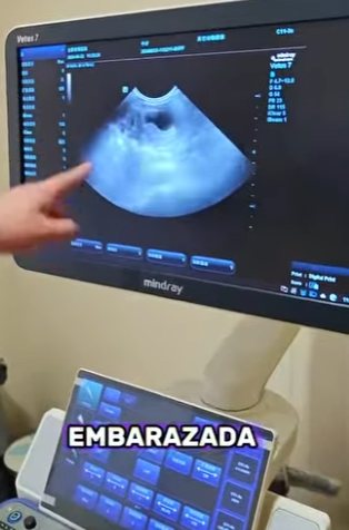 A0702006 hedgehog is really fatal (Parte 2)