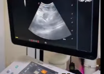 A0902011 Salvados por el amor: Un vínculo inesperado entre un hombre y un mono ahogándose (Parte 2)