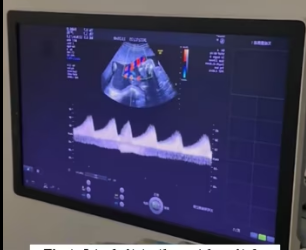 R2402001 I found a cat abandoned in a trash can. It was so pitiful that I decided to take it away, and then (Part 2)