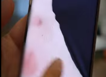 V0602008 Este perro se ataca así mismo no se sabe el porque (Part 2)