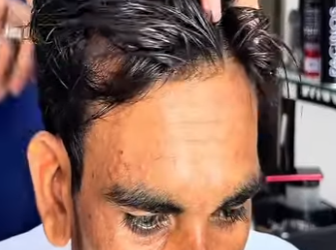 X1106005 The homeless man lived with this hair for 10 years (Part 2)